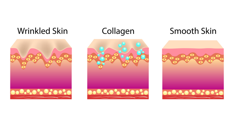 Collagen Injection - Clinical Nutrients
