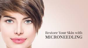 Microneedling with PRP - Clinical Nutrients